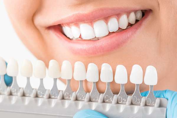Ask a Cosmetic Dentist: What Are Veneers from Garden Dental Arts in Brooklyn, NY