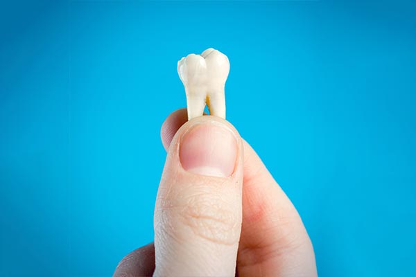 A General Dentist Helps You Decide Whether To Pull Or Save A Tooth